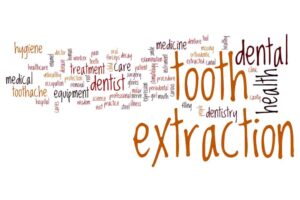 4 teeth extraction for braces before and after