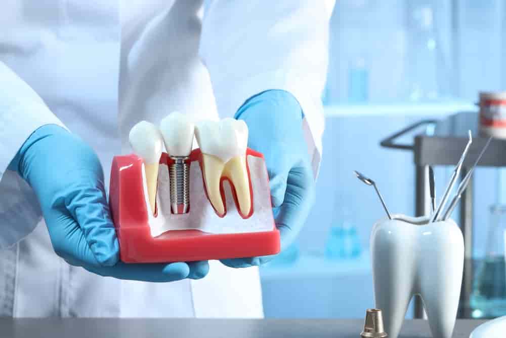 how-do-you-apply-for-government-grants-to-pay-for-dental-treatment