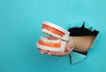 Find Grants for Dental Implants