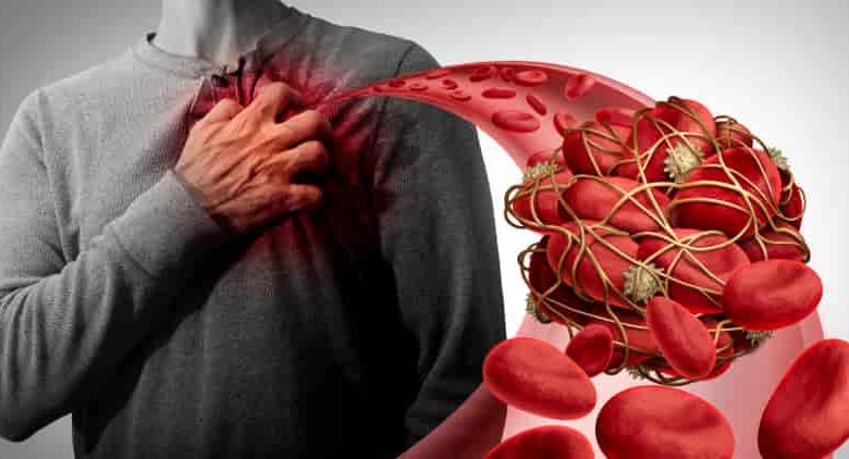 Mechanisms of Action: How Blood Thinners Work to Prevent Clots