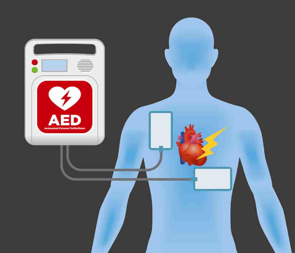What is AED? Grants for AEDs.